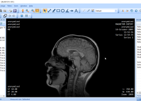 Portable MicroDicom x64 screenshot