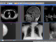 Sante DICOM Editor